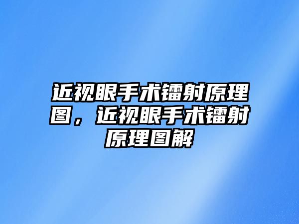 近視眼手術鐳射原理圖，近視眼手術鐳射原理圖解