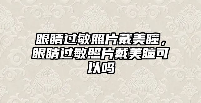 眼睛過敏照片戴美瞳，眼睛過敏照片戴美瞳可以嗎