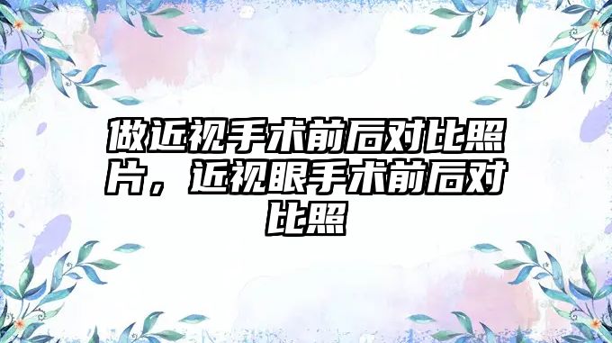 做近視手術(shù)前后對比照片，近視眼手術(shù)前后對比照