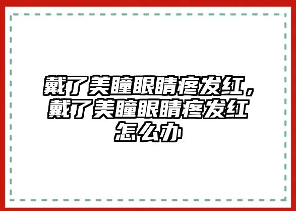 戴了美瞳眼睛疼發(fā)紅，戴了美瞳眼睛疼發(fā)紅怎么辦